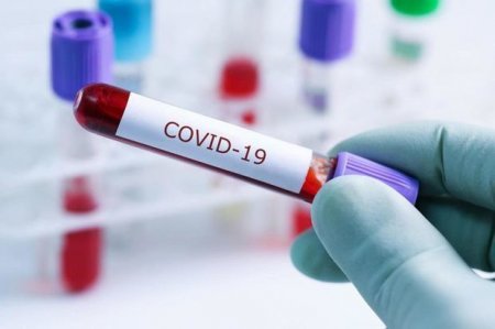 Rusiyada koronavirus statistikasında 12 gün sonra ilk yaşandı