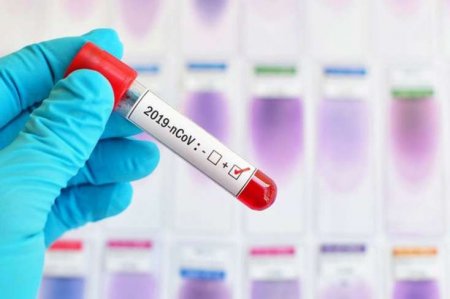 Koronavirus bu il bitməyəcək, hətta payızda... - VİDEO