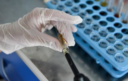 COVID-19 pandemiyasına görə İİV testləri azalıb? - RƏSMİ