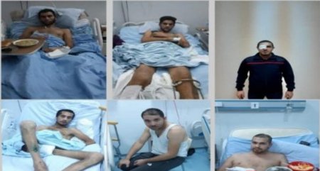 Yaralı qazilərdən etiraz: “Bizi xəstəxanadan çıxarmaq istəyirlər”