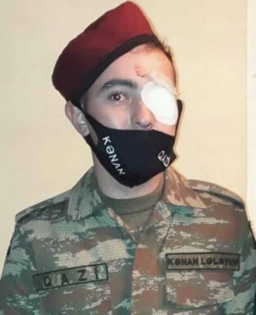 Gözünü itirmiş Qazimizdən ETİRAZ