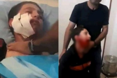 Azərbaycanda dəhşət - Canavar sürüsü şagirdləri PARÇALADI - VİDEO